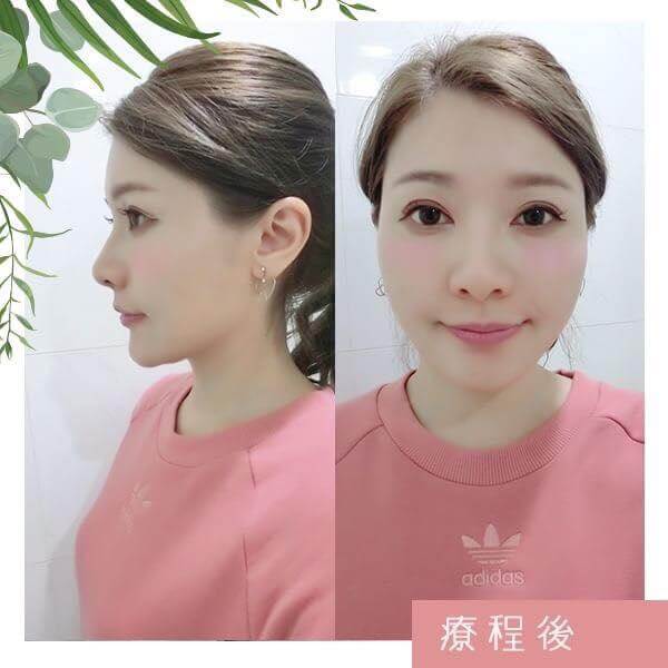 sharing-2627-thumbnail