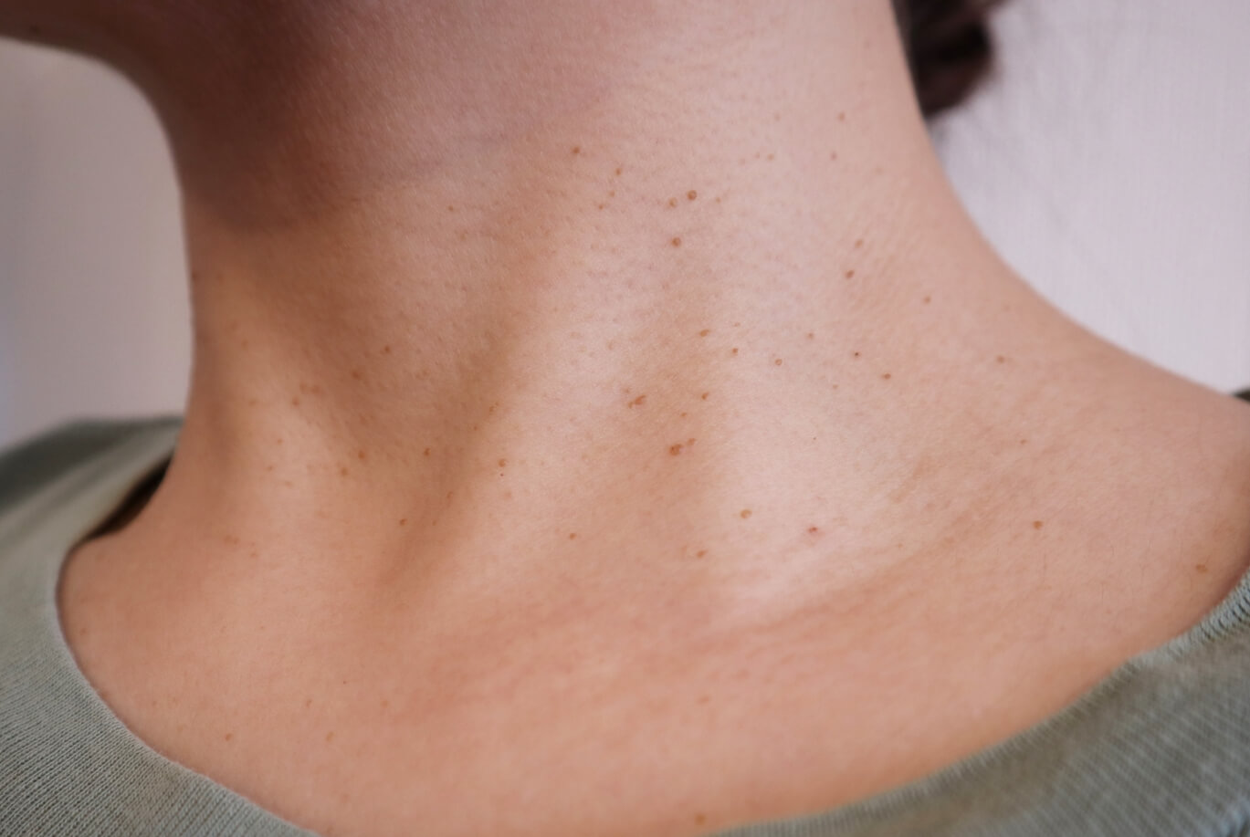 service-3559-thumbnail