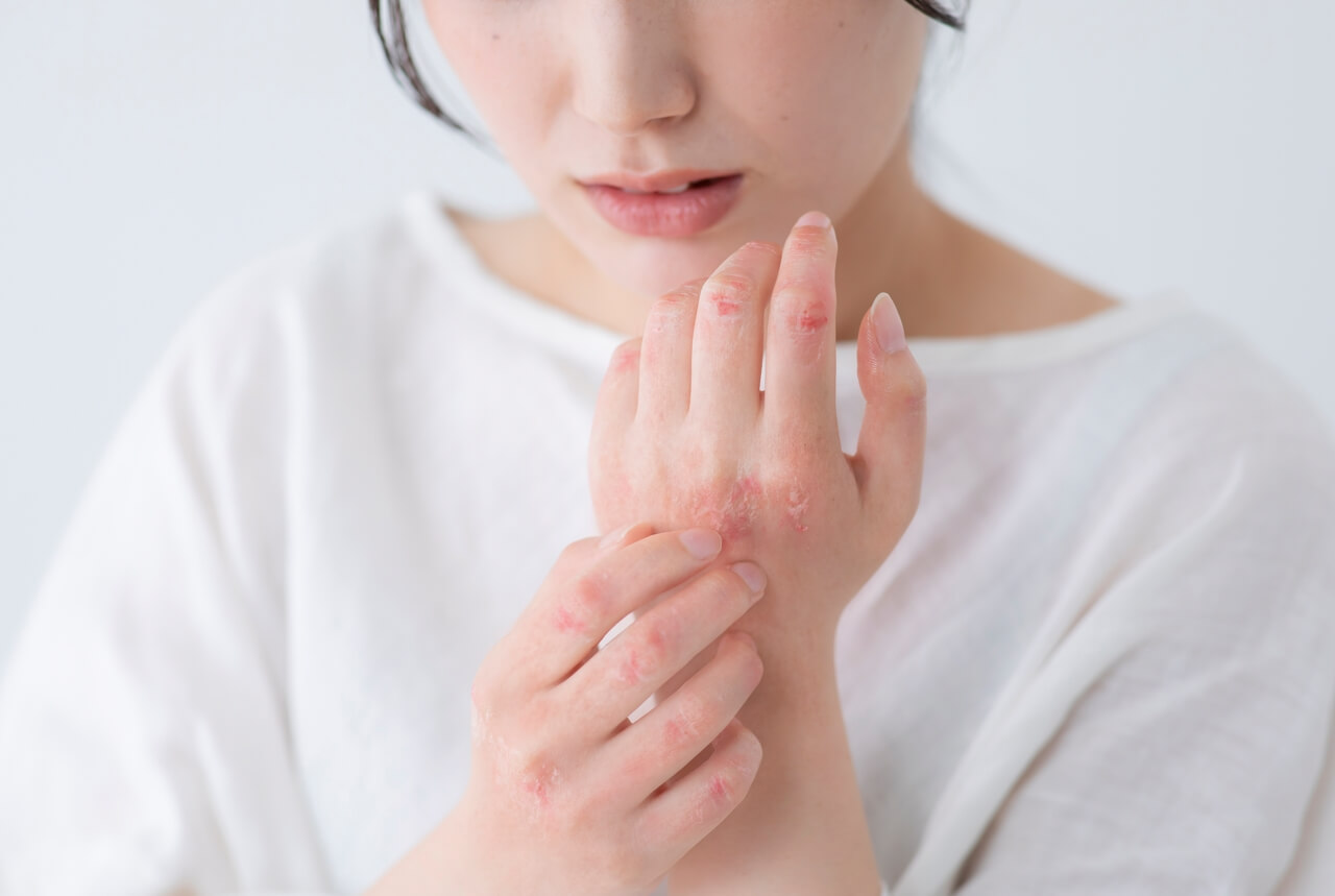 service-3560-thumbnail