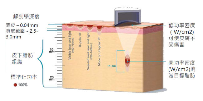 liposonix20130326-650