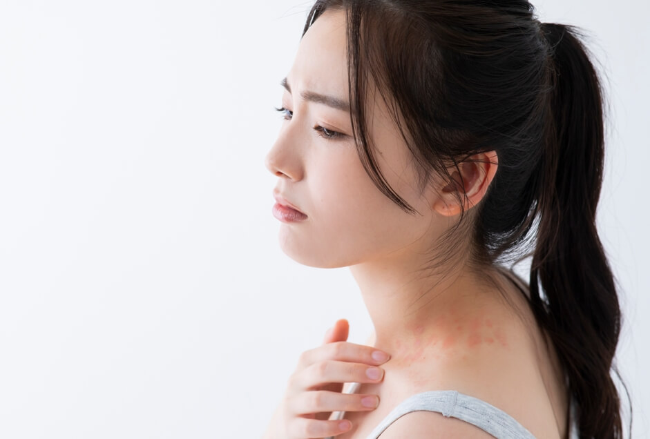 service-3543-thumbnail