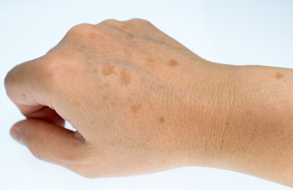 service-3542-thumbnail